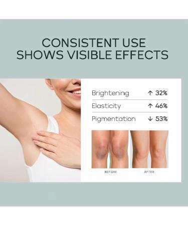 Skin Whitening Cream for Acanthosis Nigricans Skin Lightening Cream for Dark Skin Skin Bleaching Cream with Retinol for Hard Skin Fade Melanin Body Armpit Knees Elbows & Knuckles - Buy Online on GoSupps.com