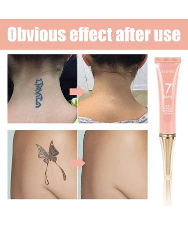 Mandurs 7 Days Tattoo Removal Cream - Fast & Painless Gel for Colored & Black Ink - 2PCS - Buy Online on GoSupps.com