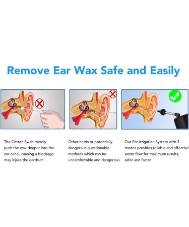 Buy Electric Ear Wax Remover - 3 Modes Rotatable Head IPX7 Waterproof Ear Irrigation System for Home Use | Fast International Shipping - Buy Online on GoSupps.com