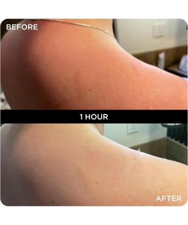 WONDERBALM LIMITED Multi Use Balm All in One Skin Cream Moisturizer for Hair Cuticles Lips and Body Moisturizing Fast Absorbing NonGreasy Olive Oil Shea Butter Vegan Natural Ingredients 20 ml - Buy Online on GoSupps.com