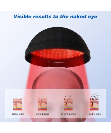 KTS Hair Regrowth Hat | Stimulate Hair Growth and Thickness - Buy Online on GoSupps.com