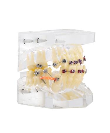 Tooth Model for Dentists & Orthodontists | Dental Orthodontic Study Model with Wire Chain for Painting Treatment - Buy Online on GoSupps.com