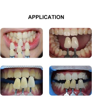 Dental Clinic 29 Colors Teeth Whitening Shade Guide 3D Shades Teeth Bleach Tooth Shade Guide - Buy Online on GoSupps.com
