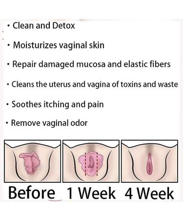 Anniecare Natural Vaginal Detox Capsules & Gel - Anti-Itch, Slimming & Repair - 5 Bags - Buy Online on GoSupps.com