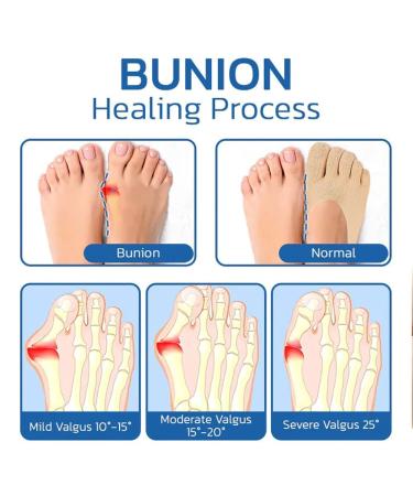 Buy Genetic Sockalign Orthopedic Compression Socks for Bunion Relief | 10 Pairs - Black - International Shipping - Buy Online on GoSupps.com