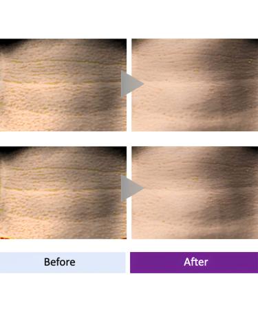 LEADERS First Shot Essence Anti-Aging Stick - Award-Winning Age Control with 94% Silkworm Extract | Portable & Easy to Use | Made in South Korea - Buy Online on GoSupps.com