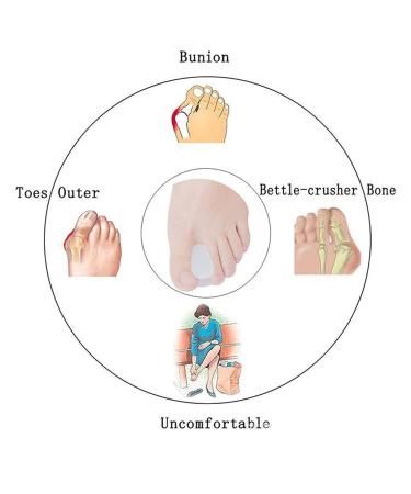 Feifan Shop 4x Toe Separator - Hallux Valgus Silicone Toe Protection & Correction Spreader for Pain Relief - International Shipping Available - Buy Online on GoSupps.com