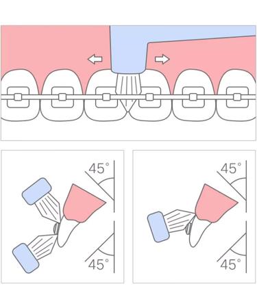 Soft Trim Dental Brush for Orthodontic Care | Compact Interdental Brush for Detailed Cleaning - 1 Pack - Buy Online on GoSupps.com