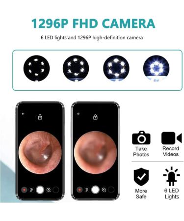 Ear Wax Removal Kit with Camera for Phones - Ear Cleaner Tools Set - White - Buy Online on GoSupps.com