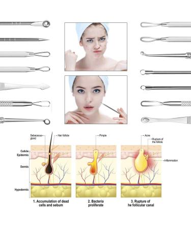 Pimple Blackhead Remover Kit - 7 in 1 Extractor Tool Set - Buy Online on GoSupps.com