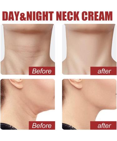 Neck Firming Cream With Retinol and Collagen Neck Tightening Cream Collagen Face & Neck Tightening Cream Rich in Hyaluronic Acid Neck Cream Strengthen Neck Cream Women Anti-Wrinkle Moisturizer Neck - Buy Online on GoSupps.com