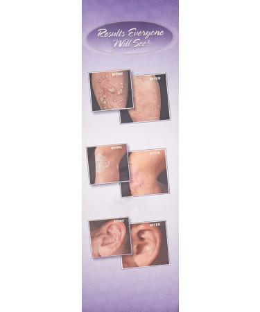 Dermazinc Zinc Therapy Spray/Drops 4 oz | Dermalogix Partners - Buy Online on GoSupps.com