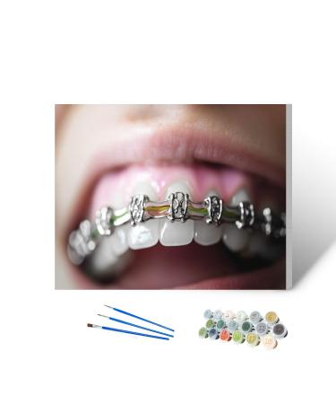 Paint by Numbers Kit for Adults cosmetic dentistry orthodontics dental metal wire teeth brackets 16x20" DIY Color by Numbers Acrylic Paint Framed Canvas Painting Kits for Beginner Students Teens Color5 16 x 20 inches