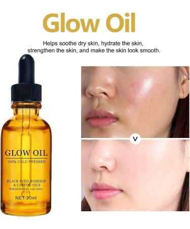 (100% Effective) 3PCS Rosehip Oil Black Seed Oil and Castor Oil | 100% Cold Pressed Black Seed Oil for Face Anti-Aging Miracle Facial Moisturizer Serum Natural Skincare Fortifying Nourishing Hydrates Skin | 30ml - Buy Online on GoSupps.com