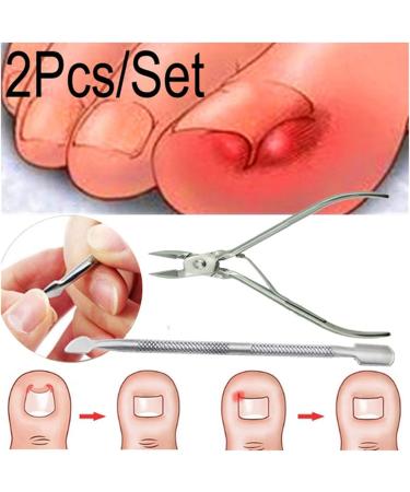 SJLS 2Pcs/Set Ingrown Toe Nail Correction Nippers Clipper Cutters Dead Skin Dirt Remover + Paronychia Podiatry Pedicure Care Tool (Color : A) - Buy Online on GoSupps.com
