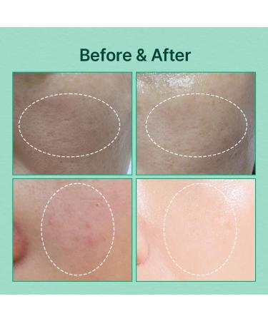 Green Caper Hydrating Essence Toner for Sensitive & Dry Skin - Vegan Cruelty-Free Korean Skincare (4.39 Fl Oz - Buy Online on GoSupps.com