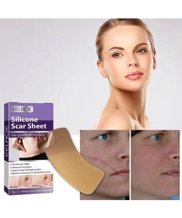 WAITLOVER Skin Color Reusable Silicone Scar Removal Patch - Surgical Self-Adhesive Soft Gel Strip for Burn Repair - Buy Online on GoSupps.com