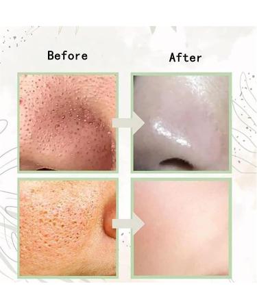 Jabon Aclarante De Arroz Thai Rice Soap Thai Rice Milk Soap jabon de arroz para aclarar la piel Jabon Blanqueador De Axilas Y Partes Intimas Jab n Blanqueador De Piel Whitening Soap (2PC) - Buy Online on GoSupps.com