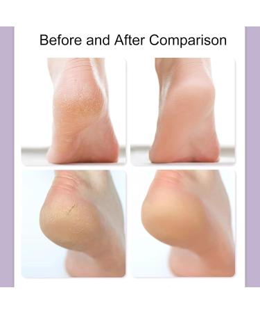 3 Pairs Silicone Socks Moisturizing Exfoliating Socks Reusable Moisturising Socks Suitable for Women & Men - Buy Online on GoSupps.com