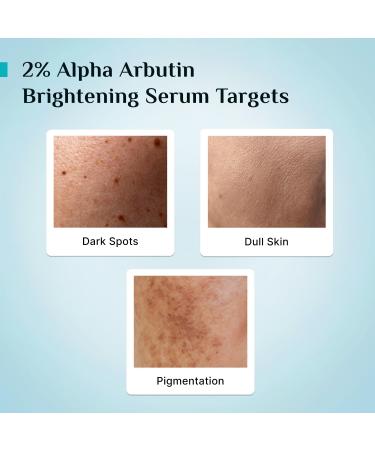 MI Korean 2% Alpha Arbutin & 3% Vitamin C Serum | Anti Aging Facial Serum | Reduce Dark Spots | Improves Skin Tone & Texture | 1.01 Fl Oz (30ml) - Buy Online on GoSupps.com
