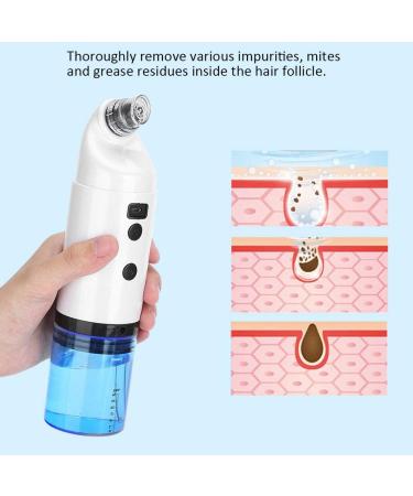 Xcello Portable Mini Electric Face Cleanse Machine Gentle Bubble Cleanser for Blackhead Suction and Pimple Removal - Buy Online on GoSupps.com
