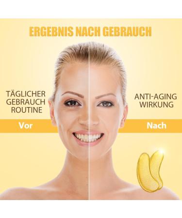 Newgo Eye Pads - 20 Pairs of Hyaluronic Acid Collagen Gel Pads for Dark Circles Puffiness & Anti-Fold Care - Buy Online on GoSupps.com