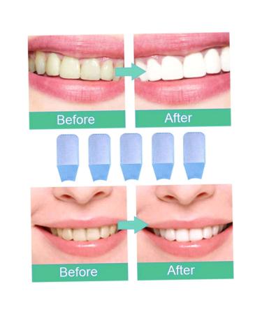 Tooth Whitening Wipes - Disposable Cleaning Towels & Teeth Cloths for Oral Hygiene | 10PC Whitening Strips Kit - Buy Online on GoSupps.com