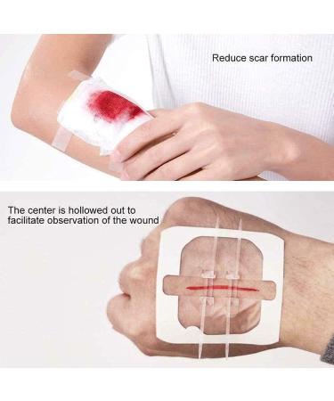 2 Pcs Zip Stitch Sutures & XL Waterproof Butterfly Strips - Hospital Grade Laceration Kit - Buy Online on GoSupps.com