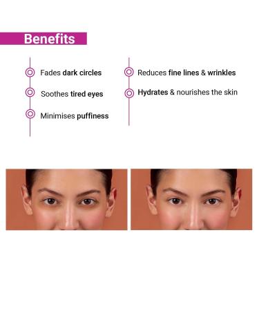 So_true i-luminate Under Eye Cream | Dark Circles Puffy Eyes & Fine Lines Solution for Women | 15g Aloe Vera Jojoba & Vitamin E | All Skin Types - Buy Online on GoSupps.com