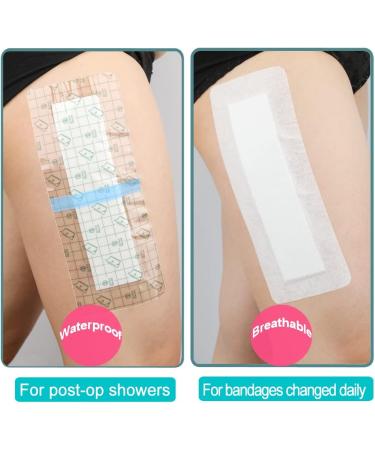 Breathable Adhesive Island Bandages - Wound Dressing for Knee Replacement | 4x8 Bordered Gauze Pad | 10 Pack for Post-Surgery Care - Buy Online on GoSupps.com