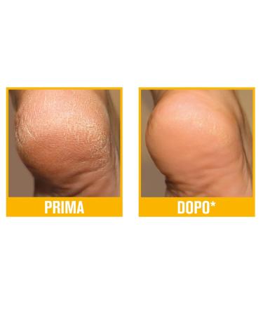 3 x Podovis Cream - Double Effect for Corns Prevention Moisturizing & Smoothing - Dermatologically Tested - 180g (3 Bottles of 60ml) - International Shipping Available - Buy Online on GoSupps.com