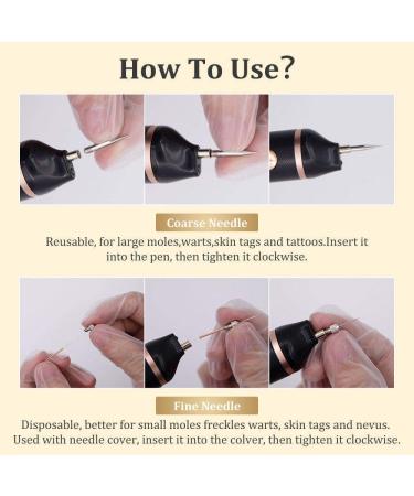  HpLNDas 15-Level Plasma Laser Pen for the Removal of Warts Moles Spots Freckles and Nevi on the Lips Hands Eyes Face Head and Nose Safe and Painless - Buy Online on GoSupps.com