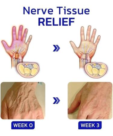 2 Pack Gfouk Numbfix Hand & Foot Spray - Relief for Joint Pain & Tenosynovitis - Fast Shipping Worldwide - Buy Online on GoSupps.com