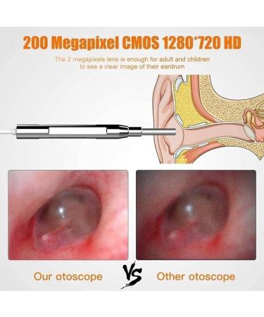 Yannies Ear Wax Removal Endoscope Ear Wax Removal Camera with 4.3 IPS Screen 1280x1080 FHD Smart Visual Ear Cleaner with Camera Tool Kit Plug & Play at Home Ear Infection Detector Ear Wax Remover O - Buy Online on GoSupps.com