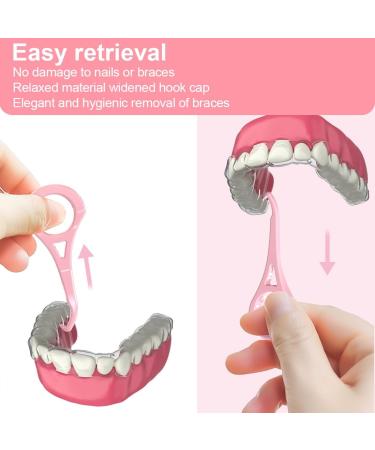 GXGM Denture Container & Dental Splint Box - Pink Braces Box with Tooth Hook | International Shipping Available - Buy Online on GoSupps.com