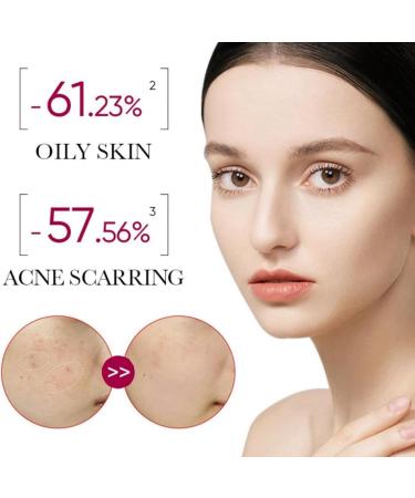 Soothing & Barrier Support Serum Barrier Serum Face Serum For Women Overnight Moist Serum Hydrating & Brightening Serum Skin Barrier Repair Cream Tightening Serum For Face Anti Redness Serum - Buy Online on GoSupps.com