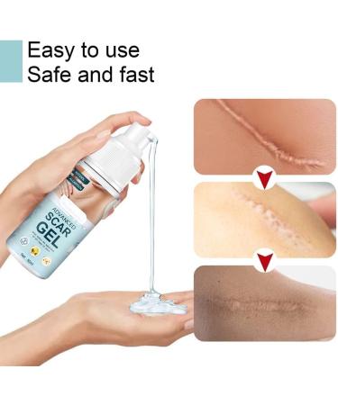 German Advanced Skin Renewal Gel Scar Gel For Acne Scars Stretch Mark Removal Cream Advanced Scar Treatment Natural Scar Therapeuti Gel Scar & Stretch Marks Remover Gel (3pcs) - Buy Online on GoSupps.com