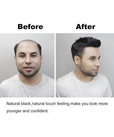Natural Black Men's Hair Piece - Thin Skin Toupee for Male Receding Hairline (13cmx14cm) - Buy Online on GoSupps.com