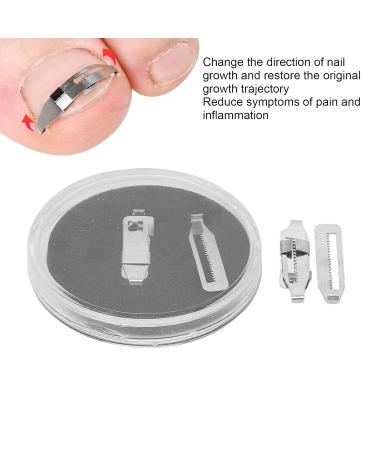 Stainless Steel Ingrown Toenail Corrector - Paronychie Tool Set (2 Pieces) | Pedicure Solutions for Nail Correction - Buy Online on GoSupps.com