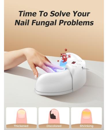 Nail Fungus Light Device for Fast Home Treatment | Repair Discolored Nails & Treat Onychomycosis Safely - International Shipping Available - Buy Online on GoSupps.com
