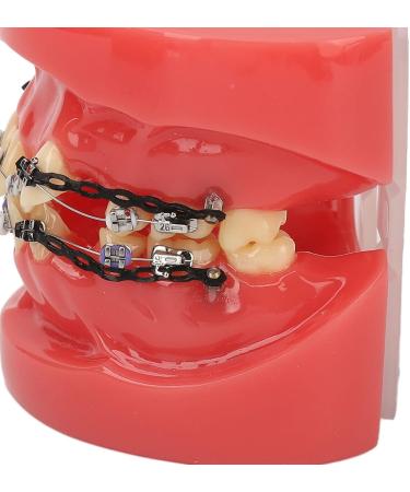 Orthodontic Demonstration Model | Professional Dental Model with Metal Wires & Brackets for Learning | International Shipping Available - Buy Online on GoSupps.com