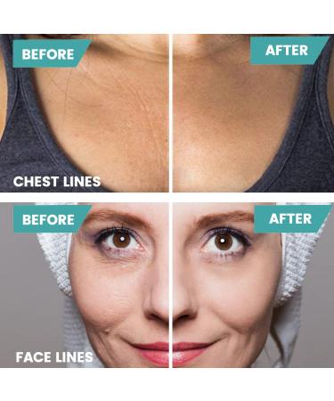Facial Wrinkle Remover Strips - 256pcs Anti-Aging Patches & Chest Pad for Smooth Skin - Buy Online on GoSupps.com