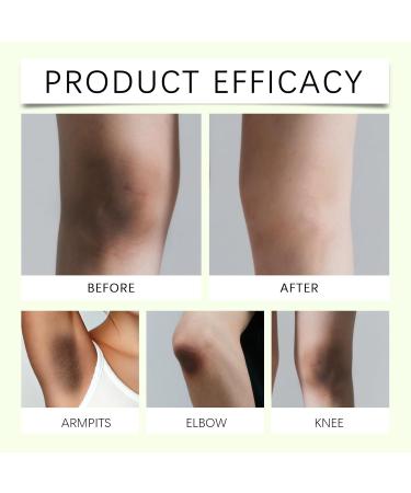 Viareline Body Care Spray Gently Cleansing Underarms Smooth Skin Care Body External Spray - Buy Online on GoSupps.com