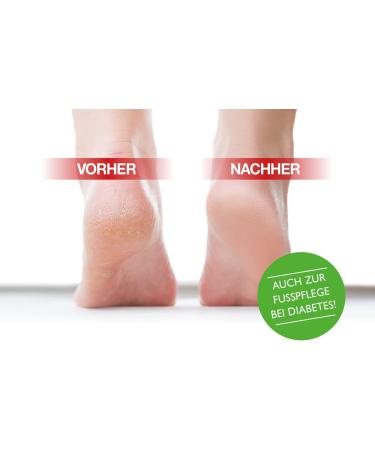 Laseepton Foot Cream 75g | Nourishing & Soothing Relief | Shop Internationally - Buy Online on GoSupps.com