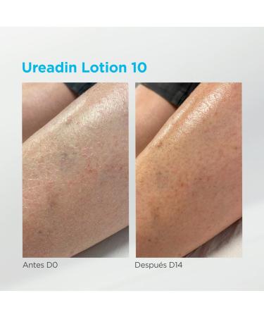 UREADIN LOCION 10 2x750ml - Hydrating Skin Lotion | 60% Off - International Shipping Available - Buy Online on GoSupps.com