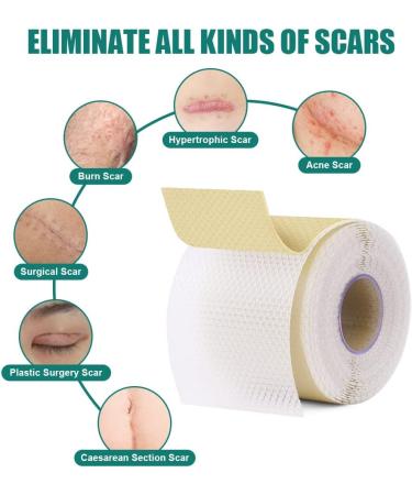 ACWOO Silicone Scar Sheets (1.6 x 120 3M) - Professional Reusable Soft Silicone Tape for Scar Removal - Ideal for C-Section, Surgery, Burn, Keloid, Acne - Painless Treatment for New & Old Scars - Buy Online on GoSupps.com