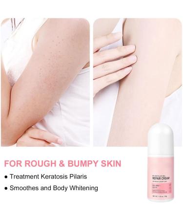 Keratosis Pilaris Cream Chicken Skin Care Cream Skin Exfoliating Repair Cream Keratosis Pilaris Treatment Legs Treatment Body Cream Rough Skin Cream For Rough And Bumpy Dry Skin 50g - Buy Online on GoSupps.com