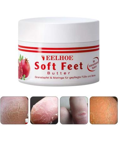 Frost Protection Cream for Feet | Anti-Crack Moisturizer & Dead Skin Foot Butter | Nourish & Repair with Effective Foot Care Cream - Buy Online on GoSupps.com