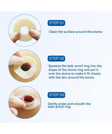 Ostomy Barrier Rings - Mouldable Colostomy Rings for Stoma Care | Prevent Leakage - Pack of 10 - Buy Online on GoSupps.com