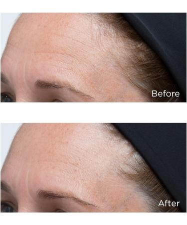 Perricone Hyaluronic Intensive Moisturizer 30ml - High Potency Classics for Glowing Skin | International Shipping Available - Buy Online on GoSupps.com